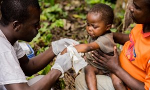 Un niño de República Centroafricana contagiado por la viruela del mono es atendido por un sanitario.