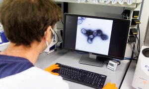 Un empleado de la compañía de vacunas Bavarian Nordic muestra una imagen de un virus en un laboratorio en Martinsried, cerca de Munich, Alemania, este 24 de mayo.