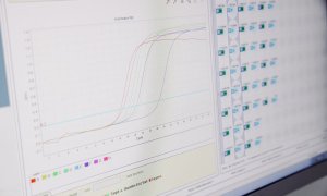 Pantalla de un ordenador con resultados positivos de viruela del mono, en el Hospital Ramón y Cajal, a 30 de mayo de 2022, en Madrid.