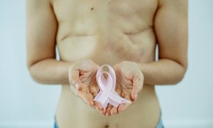 Una mujer sostiene el lazo rosa, símbolo de la lucha contra el cáncer de mama.