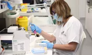Una técnico de laboratorio trabaja con pruebas PCR para detectar casos de viruela del mono