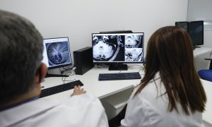 Foto de archivo de unos sanitarios observando la radiografía de un cerebro.