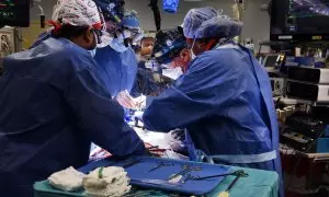 21/3/24 - Imagen de archivo de una cirugía en la que se consiguió trasplantar un corazón de cerdo a un paciente humano en EEUU, en enero de 2022.