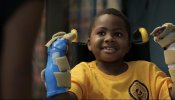 Un niño norteamericano, el primero del mundo en recibir un trasplante doble de manos