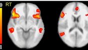 El escáner cerebral es el mejor detector de mentiras