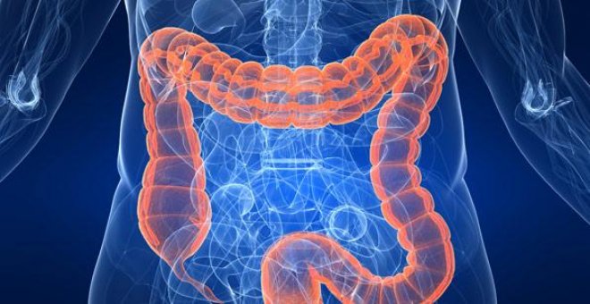 El cáncer de colon es de los más comunes en España, con 41.000 nuevos casos anuales