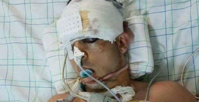 Muere el joven marroquí que llevaba 19 días en coma por la represión policial de las protestas de Alhucemas