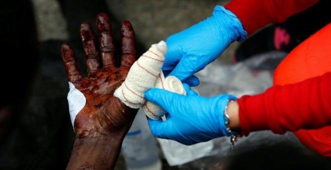Hospitalizados dos migrantes tras cortarse las arterias al saltar la valla de Ceuta