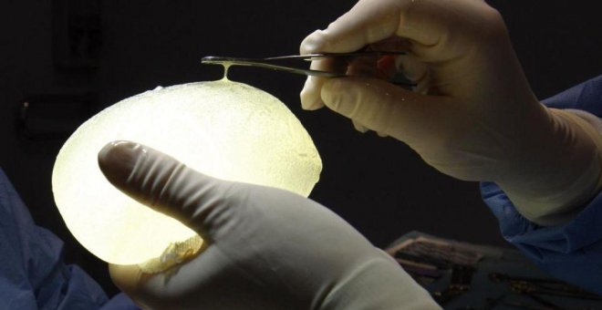 El Supremo francés ordena un nuevo proceso por los implantes mamarios defectuosos