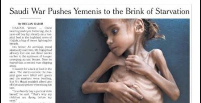Fallece la niña protagonista de la imagen que simbolizó la hambruna de Yemen