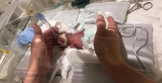 Dan de alta en Japón al bebé más pequeño del mundo, nacido con 268 gramos