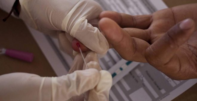 Confirman la cura de un segundo paciente con VIH