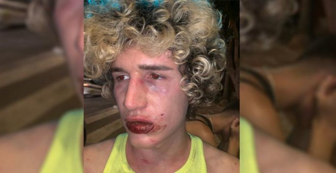 Un joven sufre una agresión homófoba a la salida de una discoteca en València