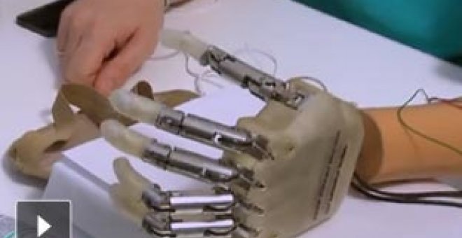 Un amputado consigue sentir en tiempo real con una mano biónica