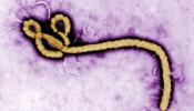Ébola, ¿por qué algunos pacientes sobreviven y otros no?