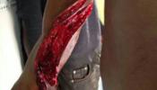 Sufre graves heridas en un brazo al intentar saltar la valla de Melilla