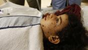Gaza se desangra tras una semana de bombardeos israelíes
