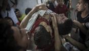 Gaza: niños muertos, niños heridos