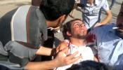Siria tortura a opositores heridos en los hospitales