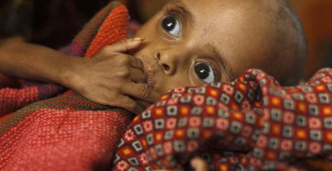 La desnutrición se ceba con 500 millones de niños en todo el mundo