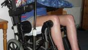 Reino Unido admite el caso de un parapléjico que pide una muerte digna