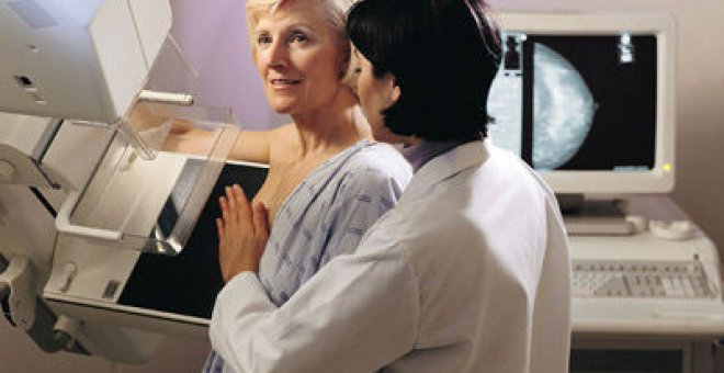 Los expertos advierten a Mato: las mamografías "no pueden ser negociables"