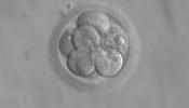 Europa revoca una patente relativa al uso de células madre embrionarias