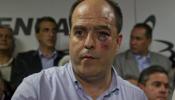Una pelea en la Asamblea Nacional de Venezuela deja varios diputados heridos