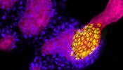 Crean por primera vez mini-riñones humanos a partir de células madre