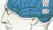 ¿Qué nos ocurre en el cerebro cuando sentimos dolor?