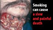 Fotos repugnantes en las cajetillas para disuadir a los fumadores