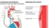 Operación pionera a corazón abierto