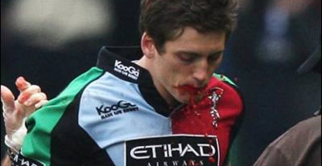 La federación de Rugby británica quiere acabar con los simuladores de hemorragias