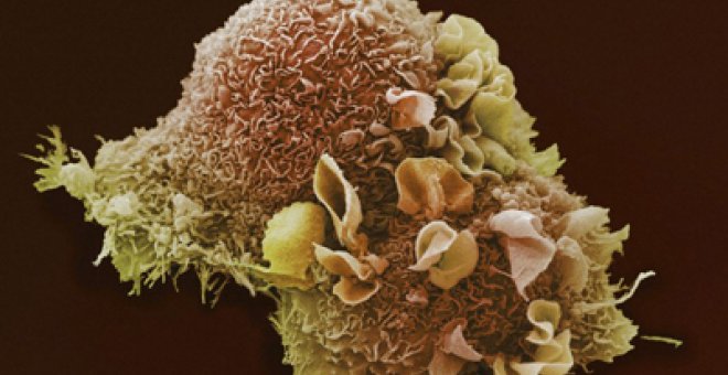 Detalladas las miles de huellas del cáncer