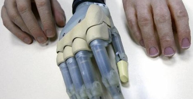 Implantan por primera vez una mano biónica con piel que permite la movilidad de dedos