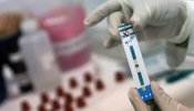 España, pionera en la investigación de fármacos antirretrovirales contra el VIH