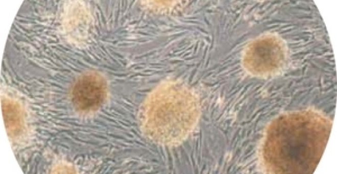 Obtienen células madre de testículos
