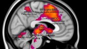 Una investigación del Hospital del Mar ayuda a localizar los mecanismos cerebrales de formación del miedo