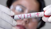 Uno de cada siete europeos con VIH desconoce que está infectado con el virus
