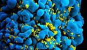 La membrana que envuelve al VIH puede ser su punto débil