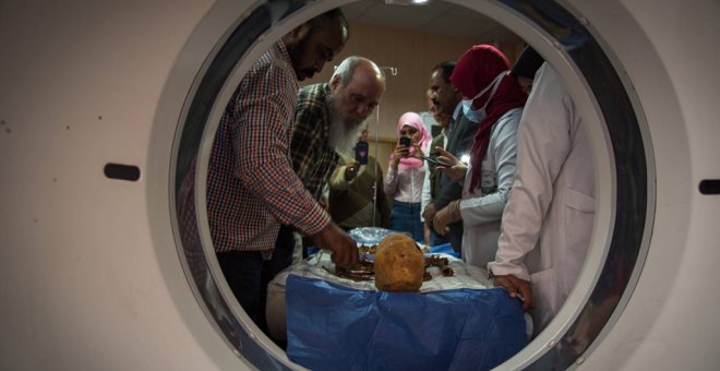 Un TAC a cuatro momias egipcias permite identificar los casos más antiguos de cáncer