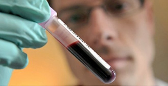 Crean un test de sangre capaz de detectar de forma temprana 8 tipos de cáncer