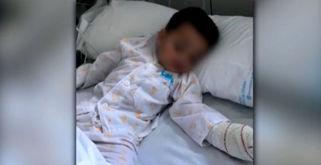 Ingresado grave un niño de 19 meses tras ser atacado por un pitbull en Madrid