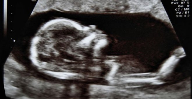 Eslovaquia podría obligar a las mujeres a ver una ecografía de su feto y a escuchar su corazón antes de abortar