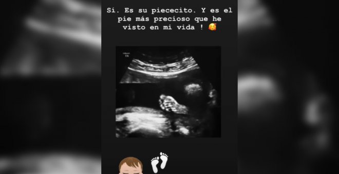 Lorena Gómez comparte con sus seguidores la ecografía de su bebé