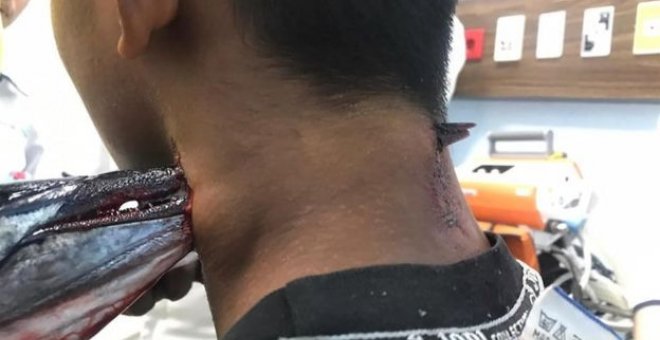 Un pez espada atraviesa el cuello de un joven en Indonesia