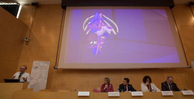 Sant Pau utilitza per primer cop a l'Estat un model d'holografies 3D per a operacions d'alta complexitat