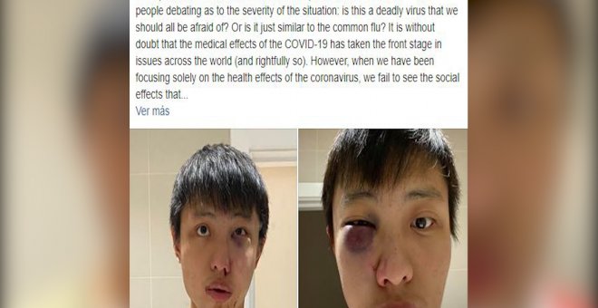 "Fuera tu coronavirus de mi país": el ataque racista a un joven de Singapur en Londres