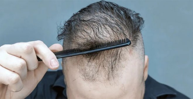 Mitos y verdades sobre el pelo y la calvicie masculina explicados por expertos