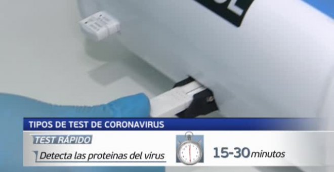 Así son los tres tipos de test para detectar el coronavirus